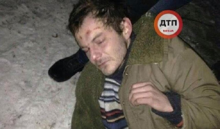Чоловік ледь не замерз: медиків і поліцію звинуватили в бездіяльності (фото)
