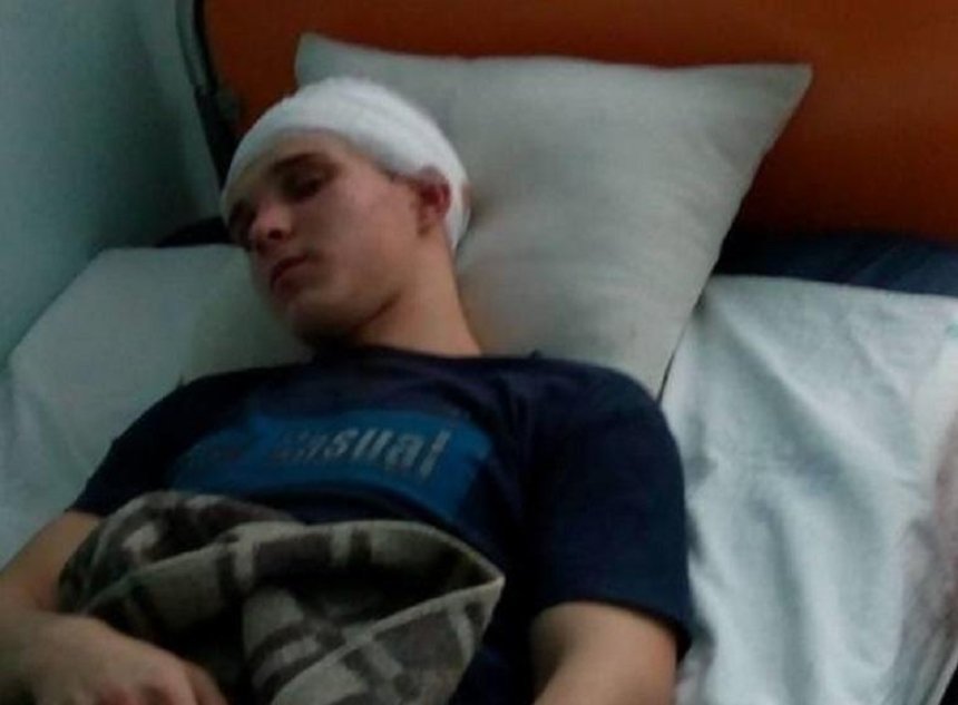 На Киевщине подростки жестоко избили ровесника в новогоднюю ночь (фото)