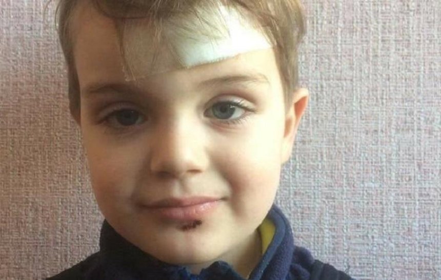 В Киеве на детской площадке пострадал ребенок (фото)