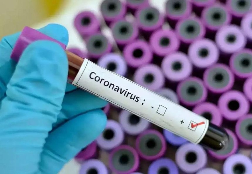 Украина получила тест-систему для выявления китайского коронавируса