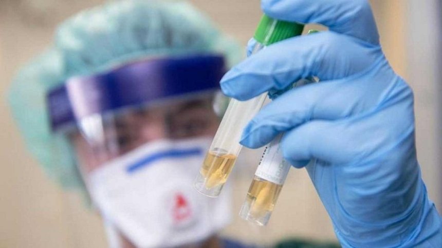 Украина получила 30 наборов реагентов для тестирования на коронавирус