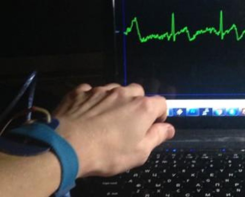 Украинская команда делает браслет, который читает кардиограмму и мониторит здоровье пользователя