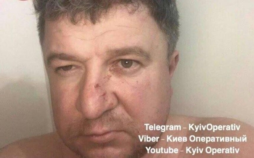 Экс-главу Ассоциации наружной рекламы Киева обвиняют в нападении на жену и убийстве собаки