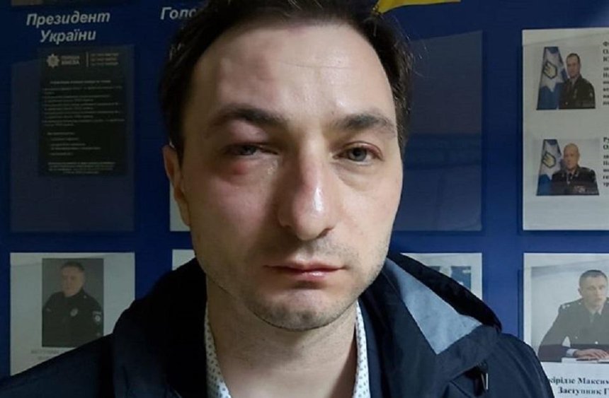 В Киеве напали на главврача Национального института рака 