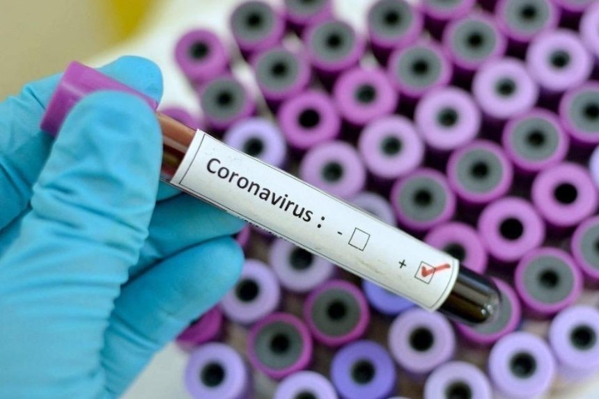 В Черновицкой области подтвердили еще пять заболеваний коронавирусом