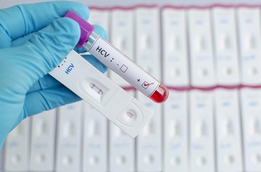 В Киеве можно будет бесплатно провериться на ВИЧ и гепатит