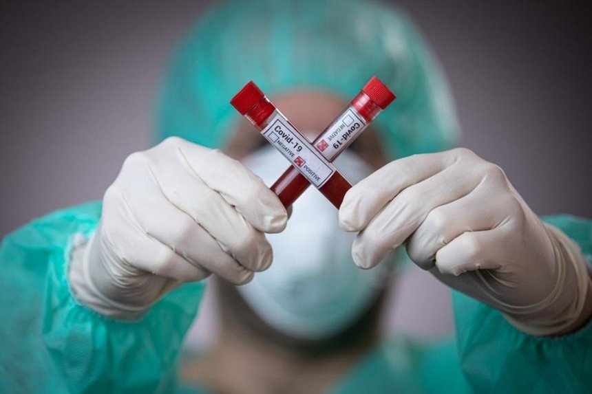 В Украине зафиксировали 5 449 случаев заболевания коронавирусом, — МОЗ