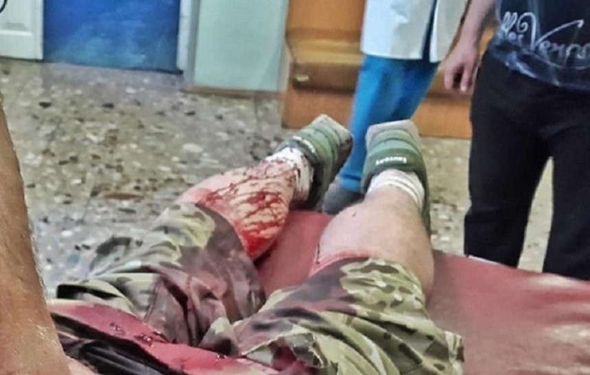 В центре Киева неизвестные напали на ветерана АТО (фото)