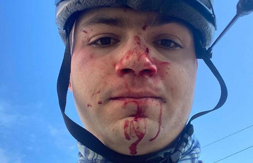 Не дал проехать по тротуару: в Киеве водитель побил велосипедиста