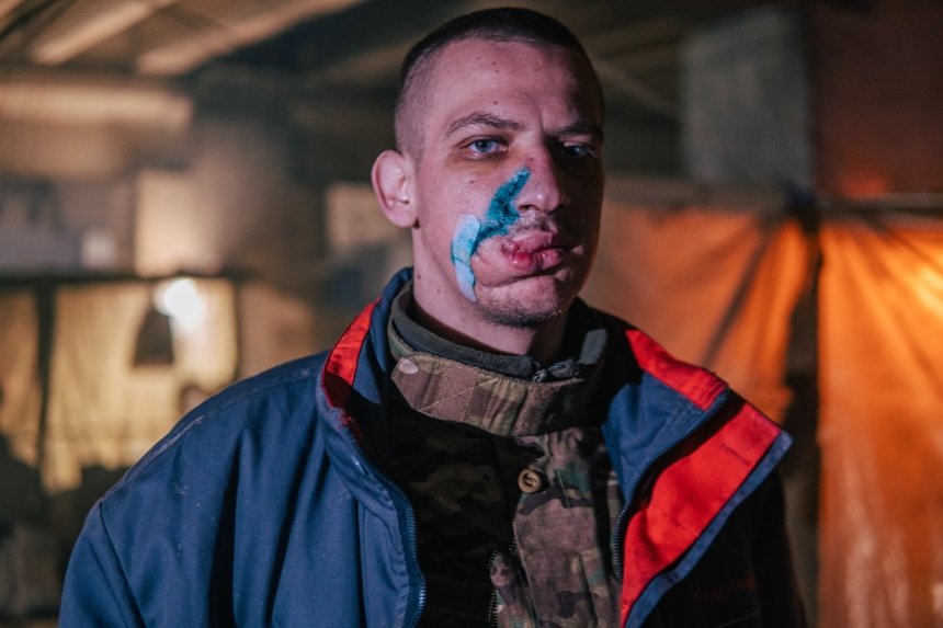 Боєць полку Азов із пораненням на обличчі у підвалах Азовсталі