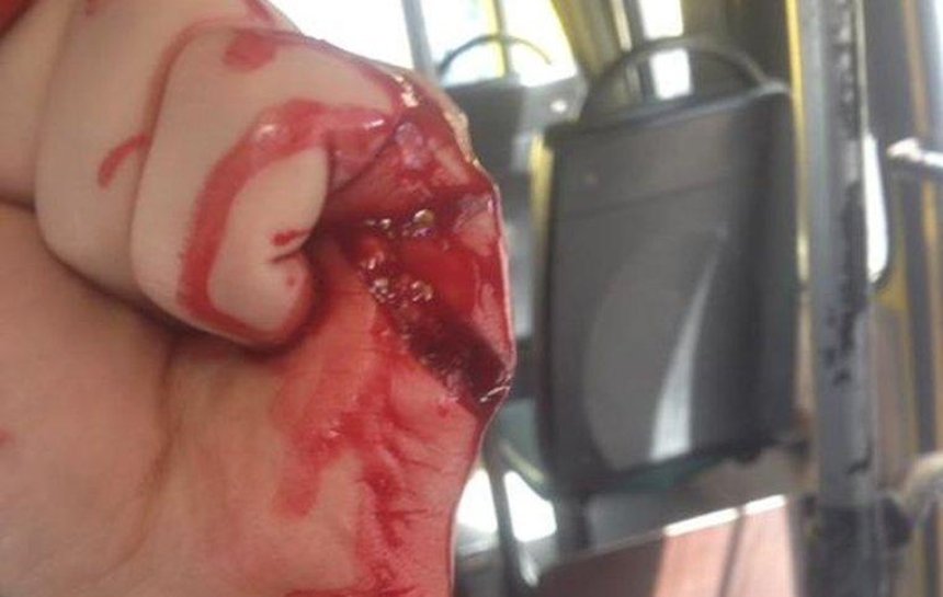 Водитель киевской маршрутки напал с ножом на АТОшника (фото)