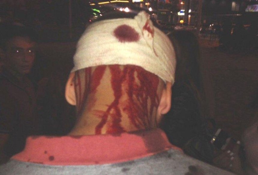 Біля Південного вокзалу роми напали на підлітка та розбили йому голову (фото, відео)
