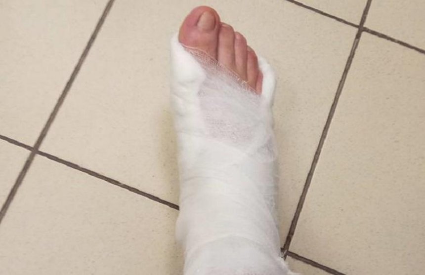 Туда не ходи: киевлянин сломал ногу из-за столичных тротуаров (фото)