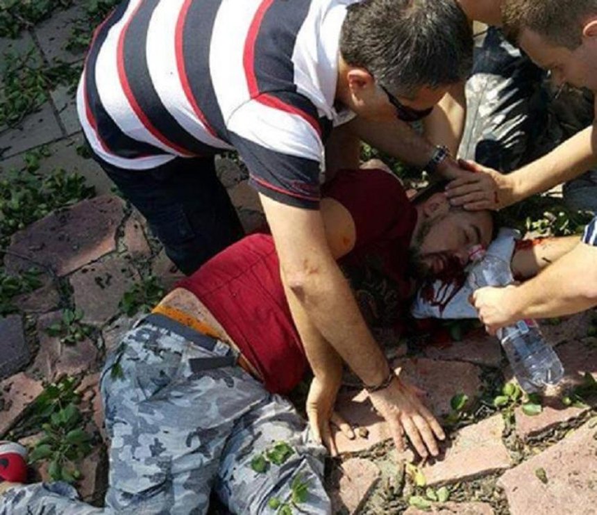 Иностранцу, на которого в Киеве упало дерево, срочно нужна кровь (фото, видео)