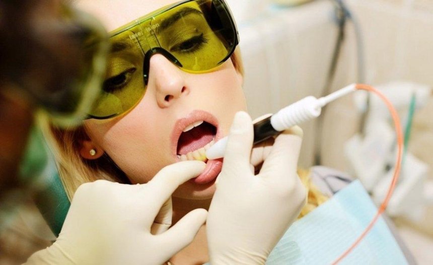 Заменит ли лазерная хирургия в стоматологии традиционную?