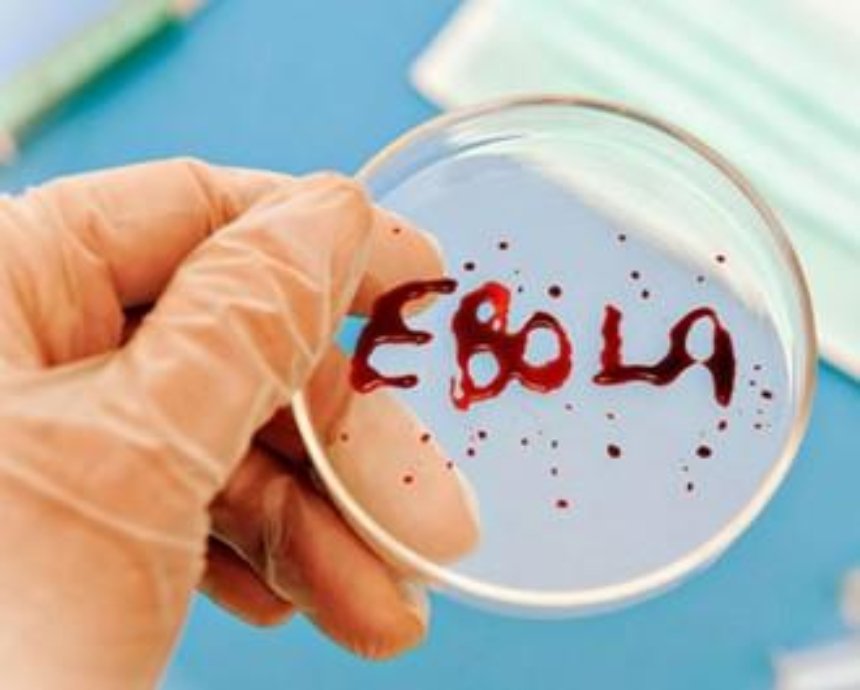 Киевские медики научатся быстро определять лихорадку Эбола