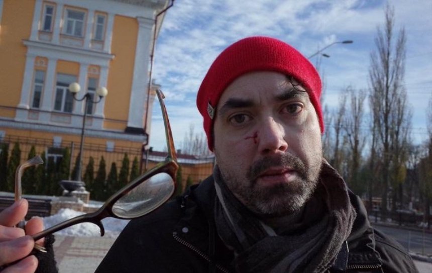 В Киеве побили иностранного журналиста 