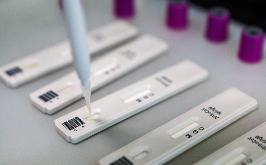 Минздрав начал внедрять тесты украинского производства на коронавирус