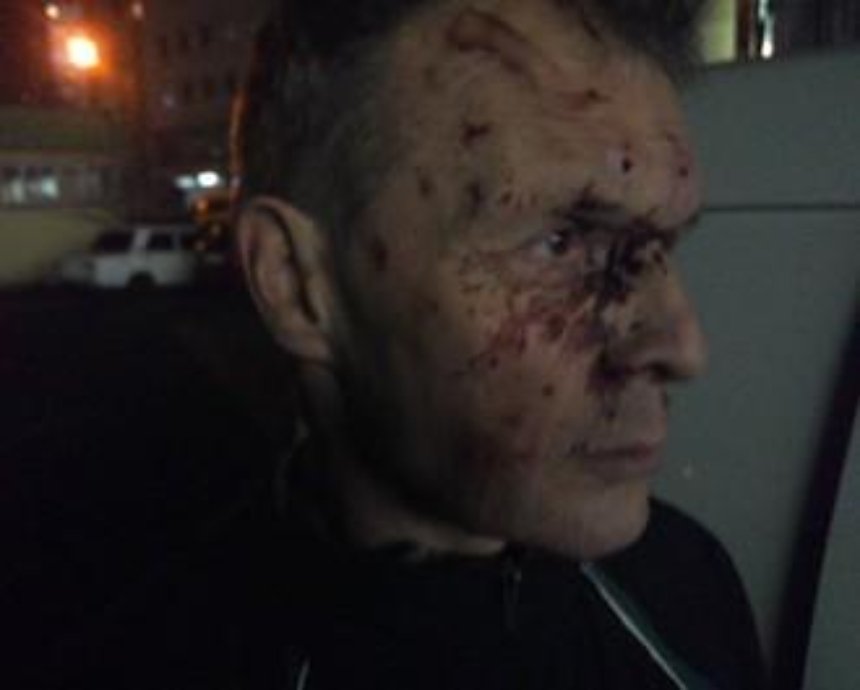 В Киеве мажор жестоко избил отца добровольца из "Азова"