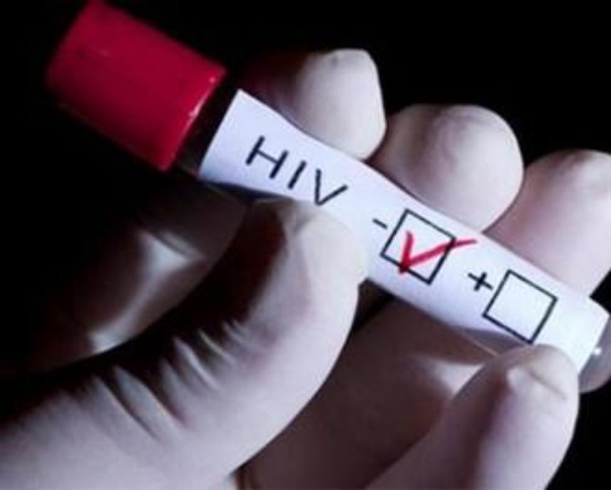 Тест на ВИЧ может стать платным