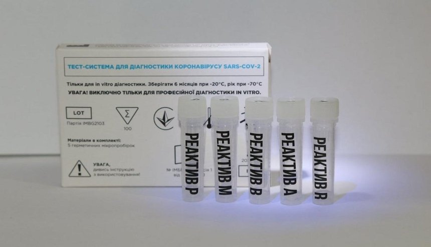 Три в одном: в Украине создали комбинированный ПЦР-тест на коронавирус и грипп