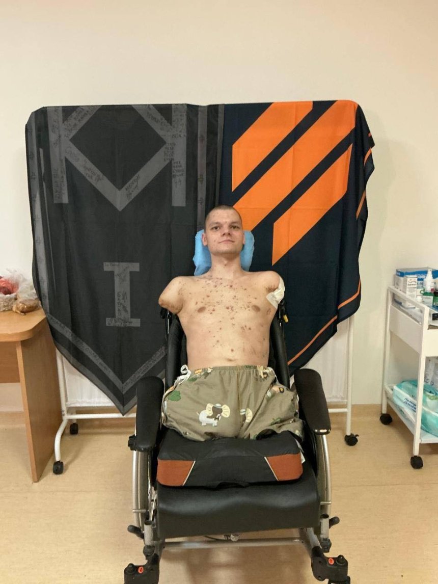 ПриватБанк відмовив військовому без кінцівок у відновлення картки: реакція банку та голови НБУ