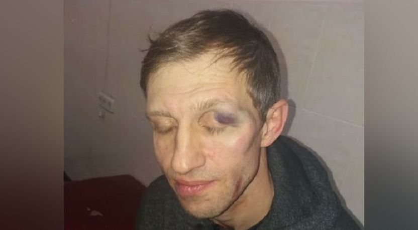 Избиение физрука на Оболони: появились фото избитого учителя (фото)