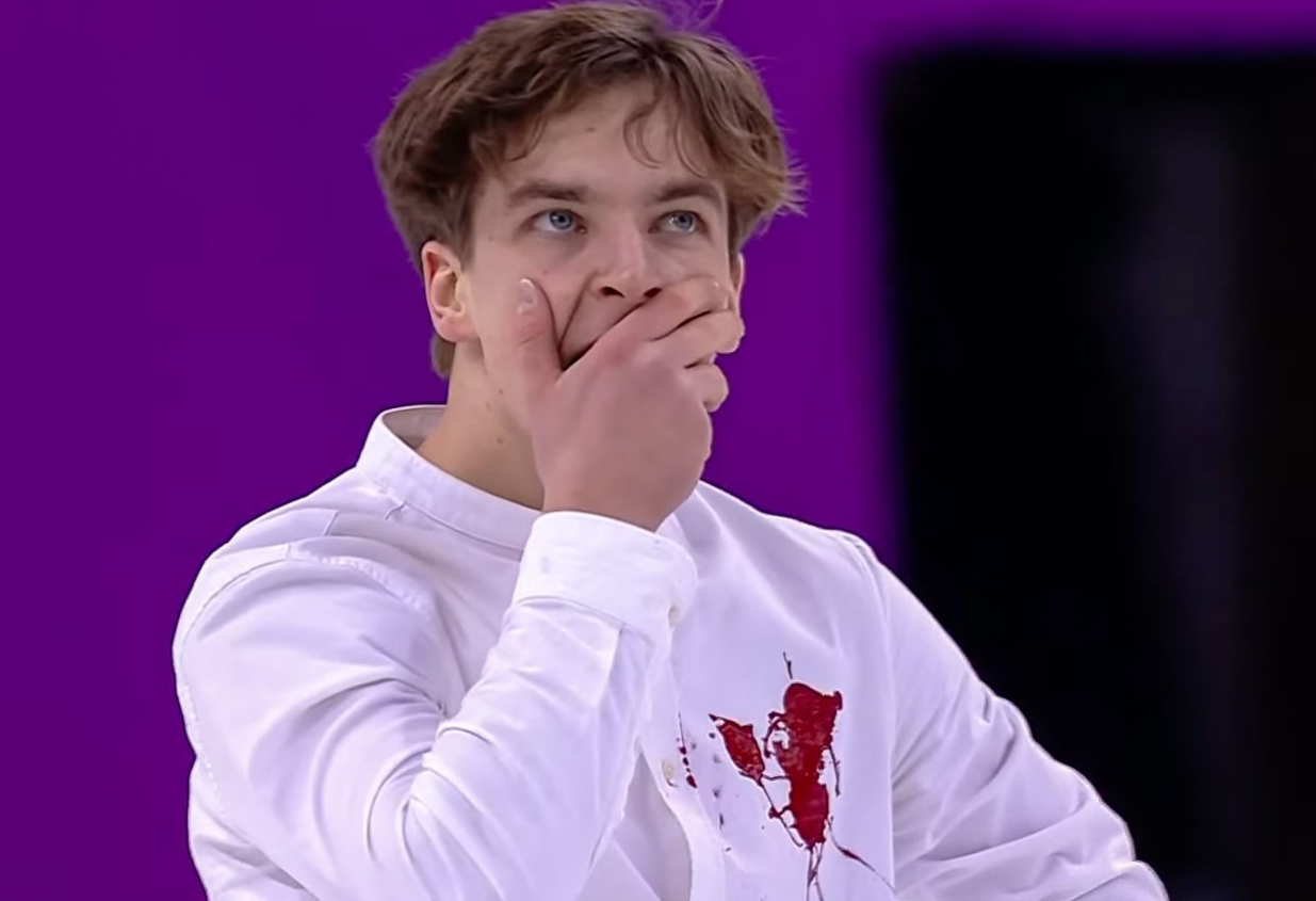 Фігурист Іван Шмуратко виступив на Євро-2024 із плямою крові на сорочці: фото, відео