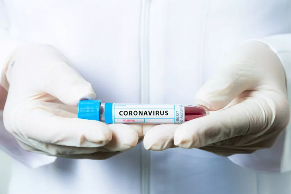 В Киеве зафиксировано 20 новых случаев заболевания коронавирусом, — Кличко