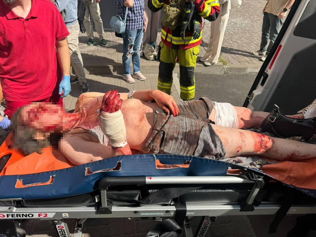 У Києві росіяни атакували будівлю телеканалу "Ми — Україна": є поранені