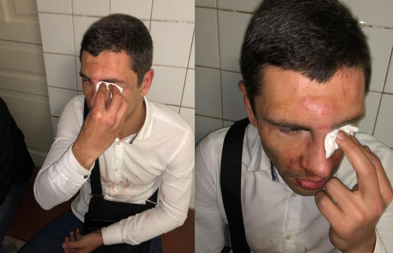 В Киеве напали на соратника Ляшко 