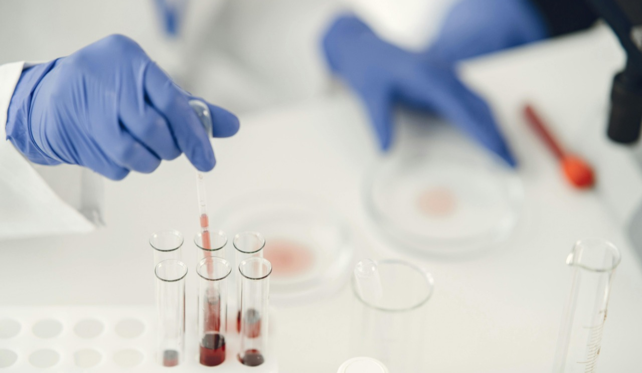 На Київщині зафіксували спалах хвороби Коксакі: що це і як уберегтися